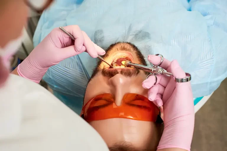 Dental Extraction Procedure: Step-by-Step Guide