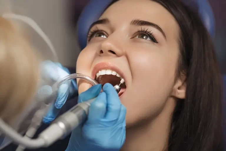 Deep Dental Cleaning Procedure Explained Step by Step