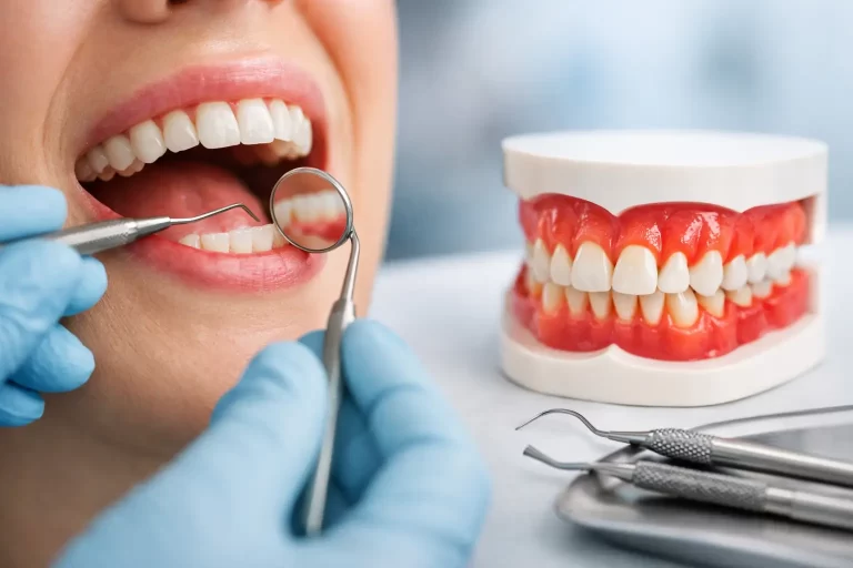 Gum Disease Guide for Early Signs and Treatment
