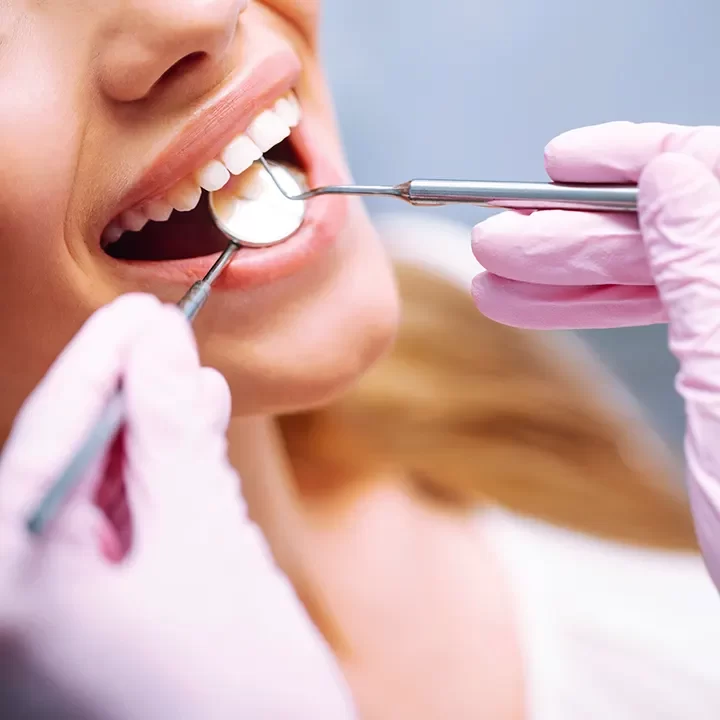 Dental Bonding