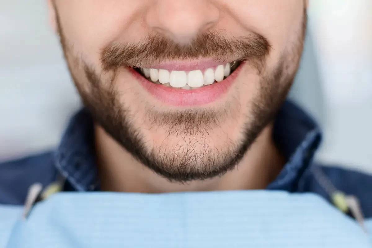 Dental Bridges