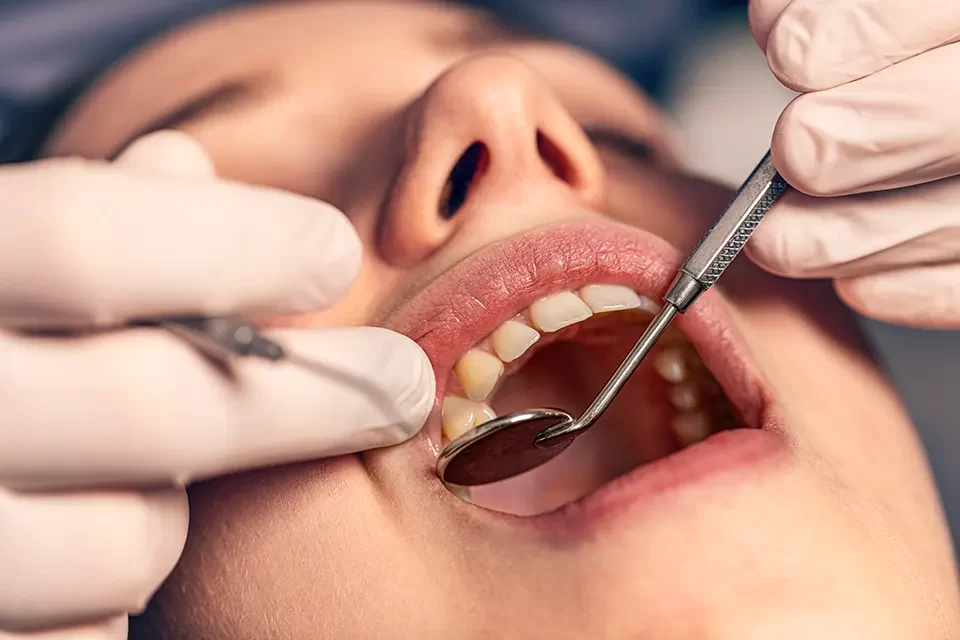 Dental Bridges