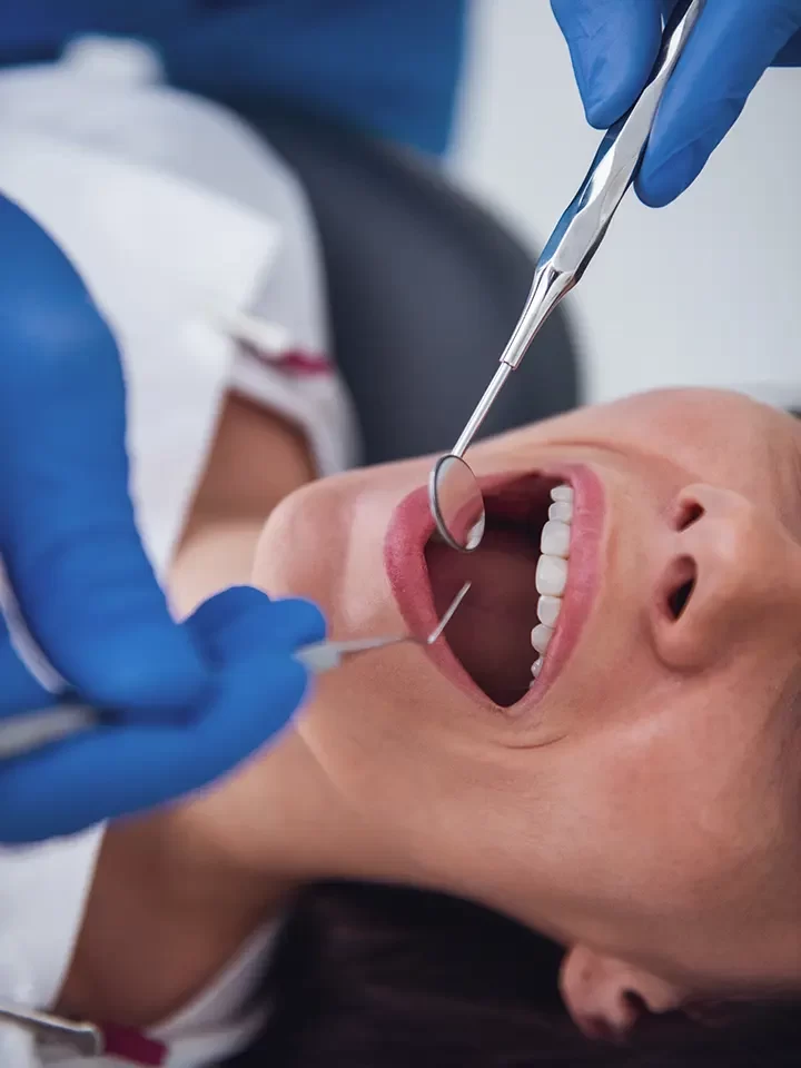 Dental Bridges