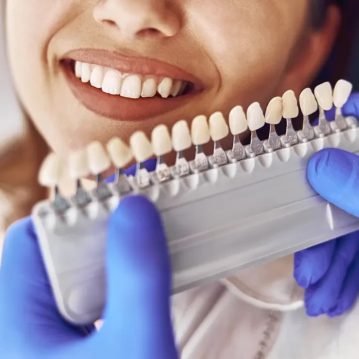 Dental Bridges