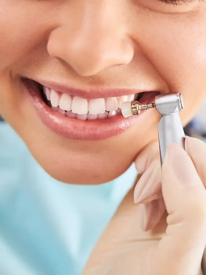 Dental Cleaning