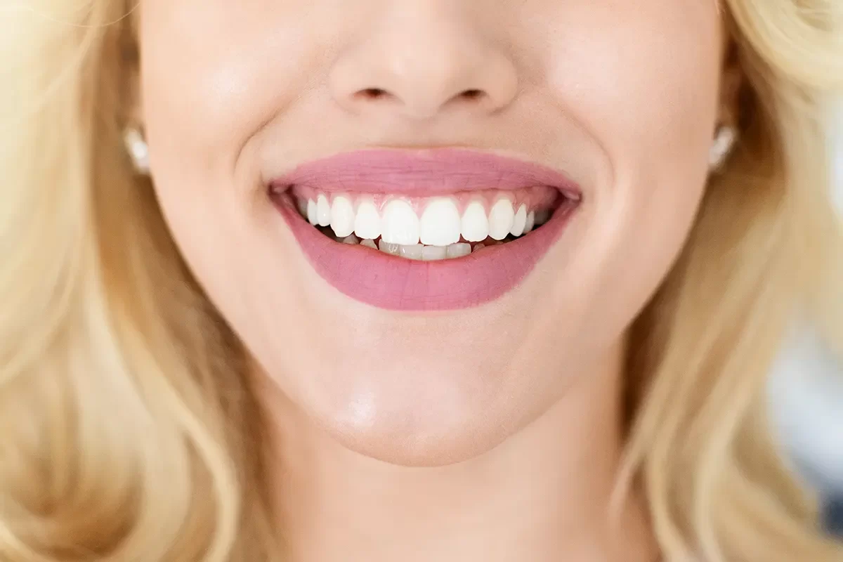 Dental Crowns