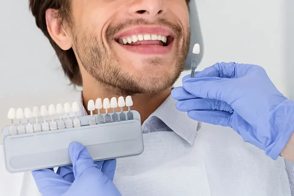 Dental Crowns