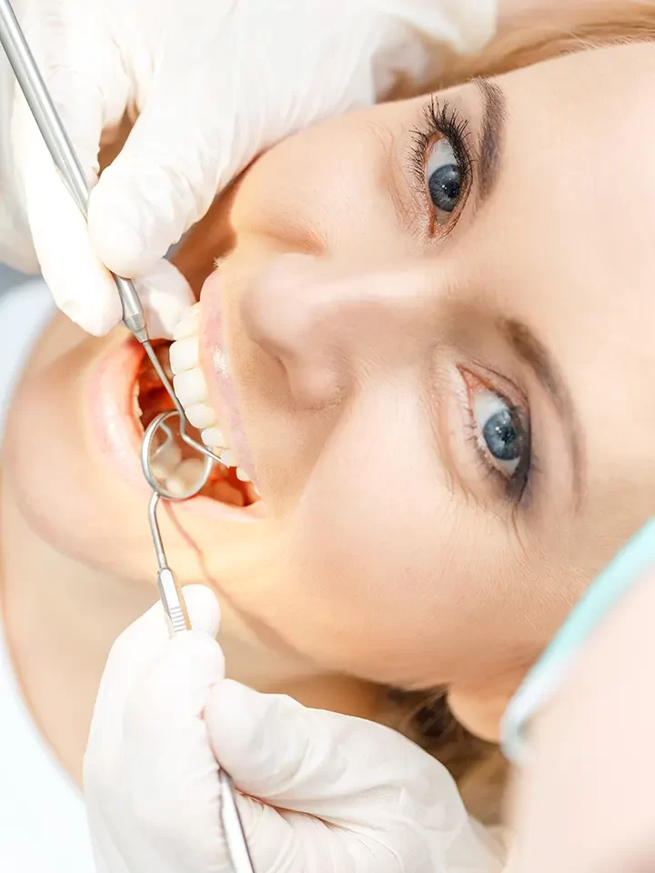 Dental Crowns