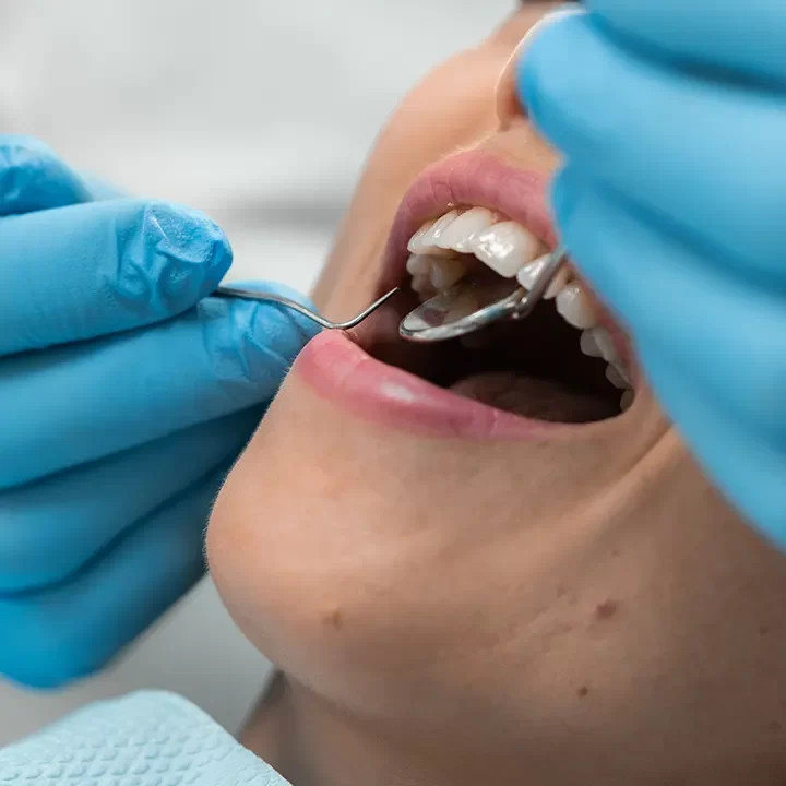 Dental Extraction