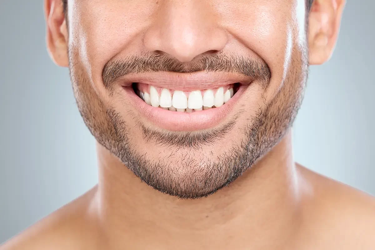 Dental Fillings