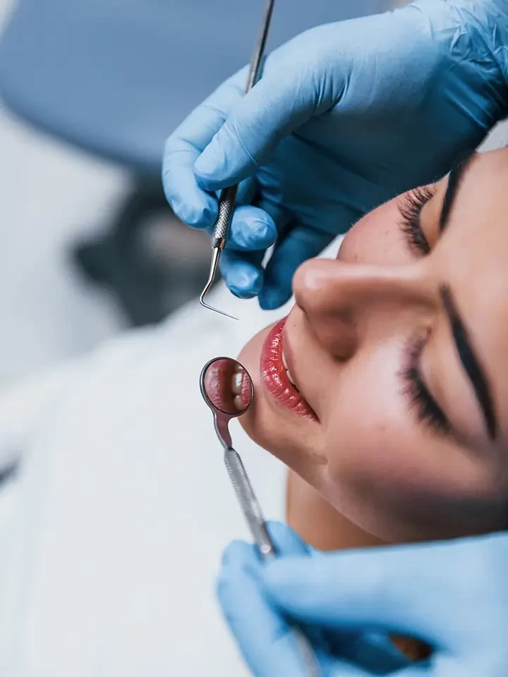 Dental Fillings