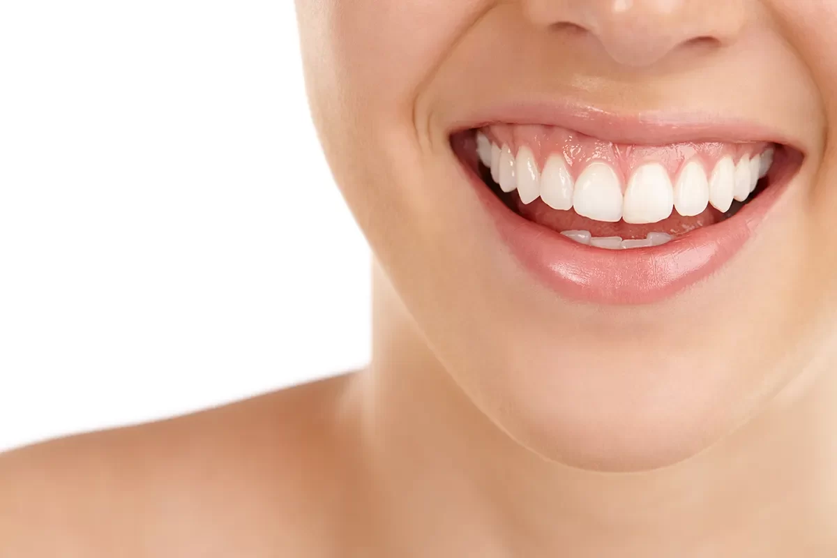 Dental Sealants