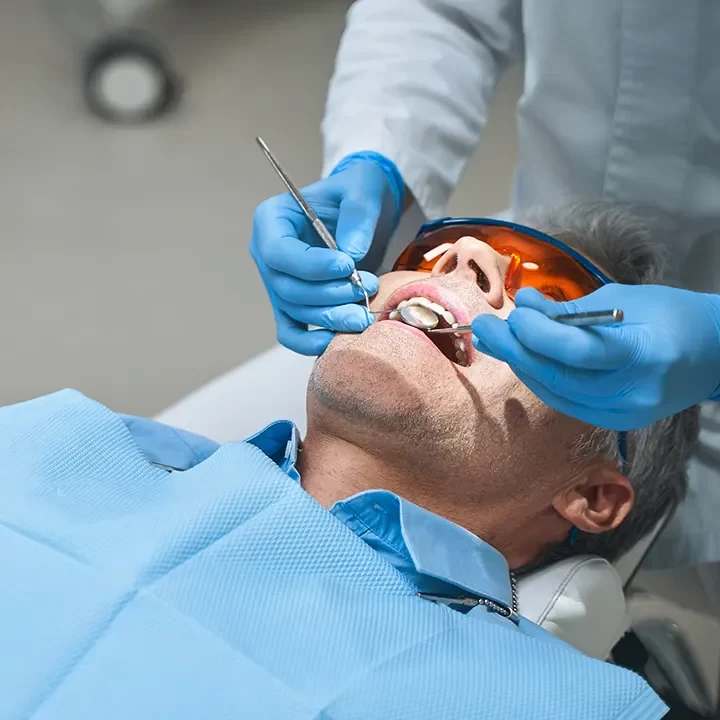 Dental Sealants