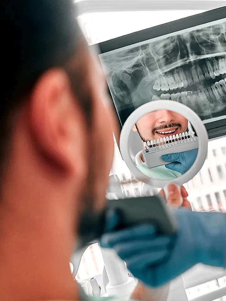 Dental Veneers