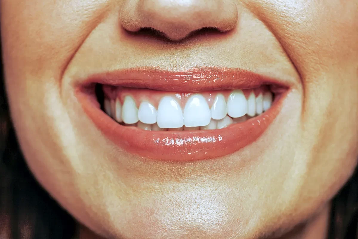 Dentist in Bayview Glen