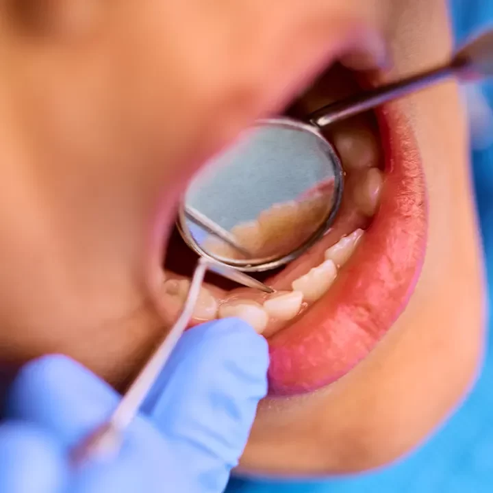 Dentist in Crestwood–Springfarm–Yorkhill