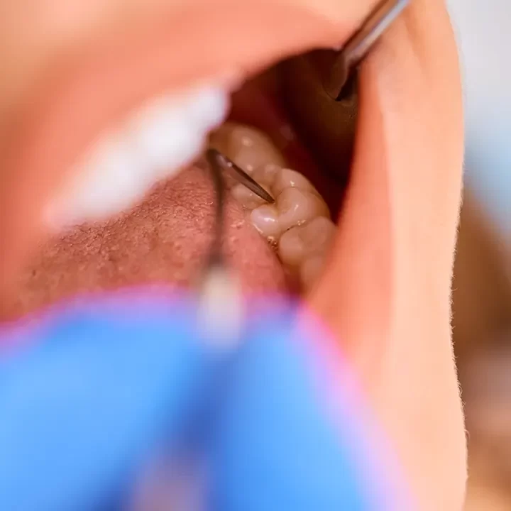 Dentist in Newtonbrook