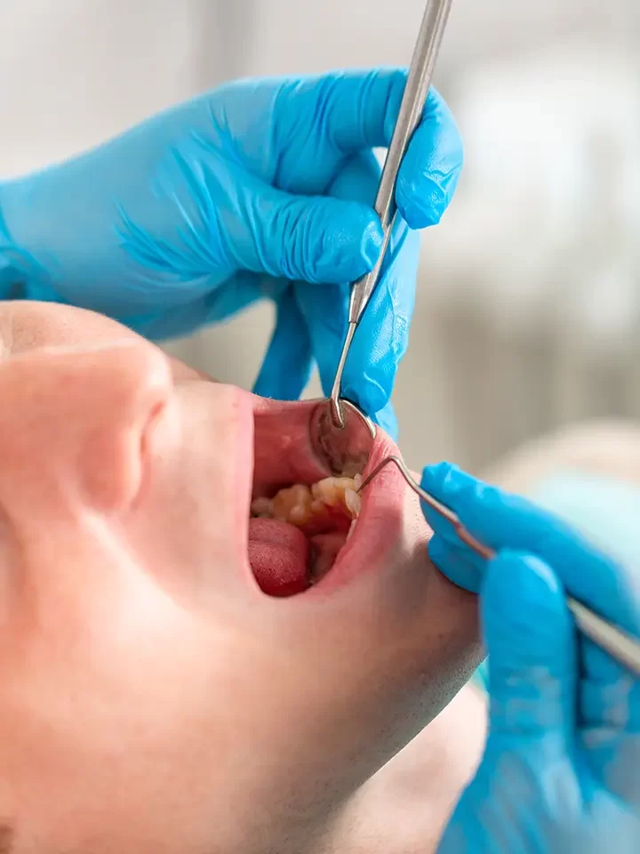 Emergency Dentistry