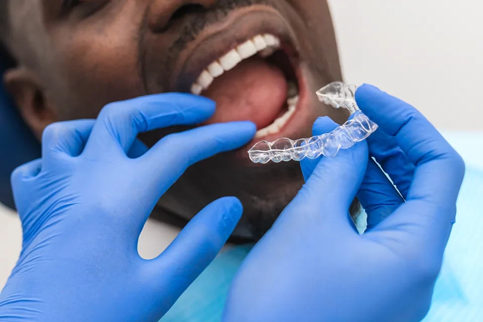 Invisalign