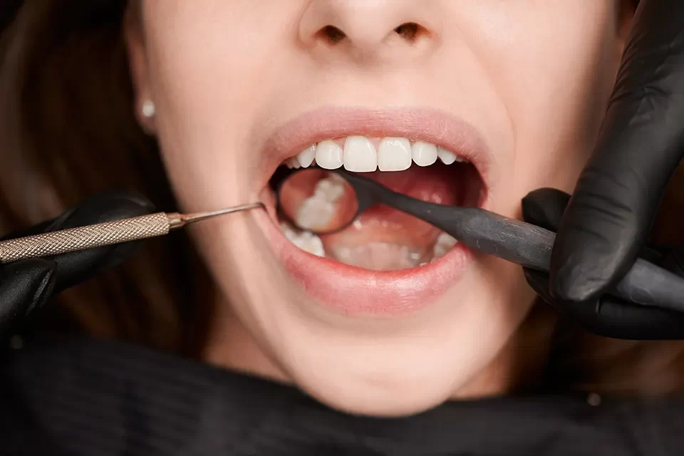 Oral Cancer Screening