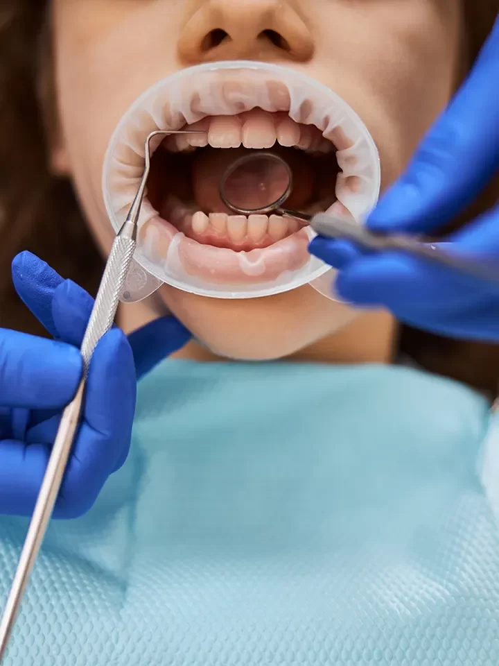 Oral Cancer Screening