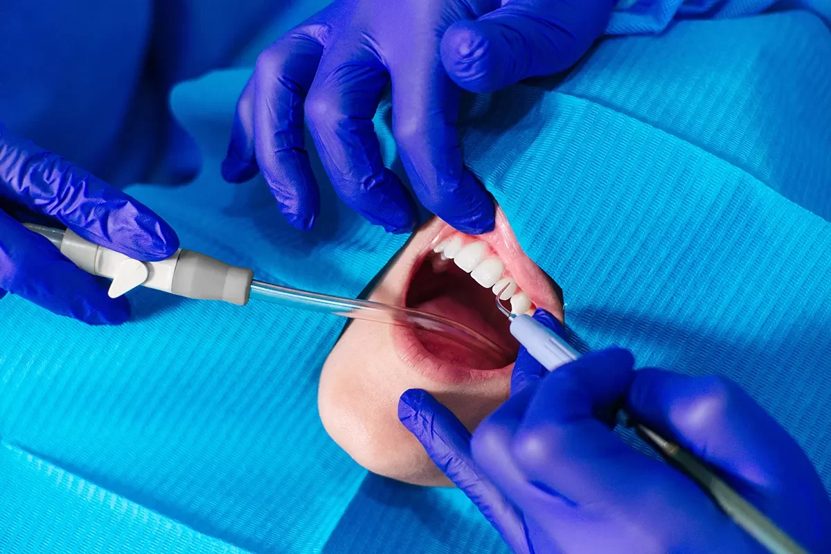 Oral Surgery