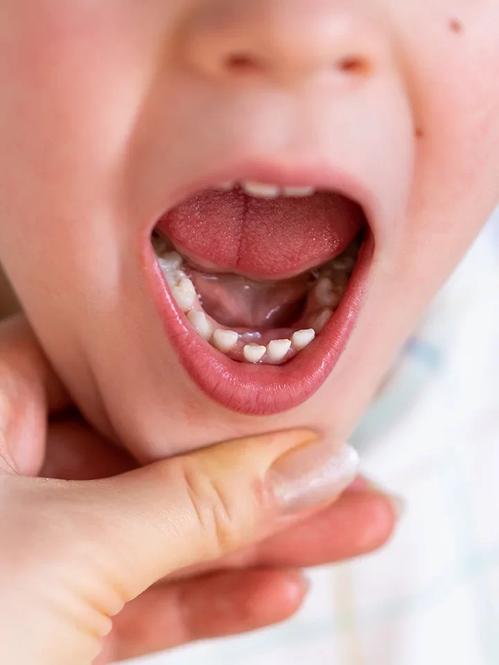 Pediatric Dentist