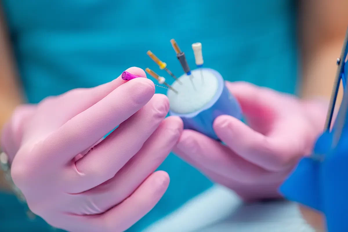 Root Canal Treatment