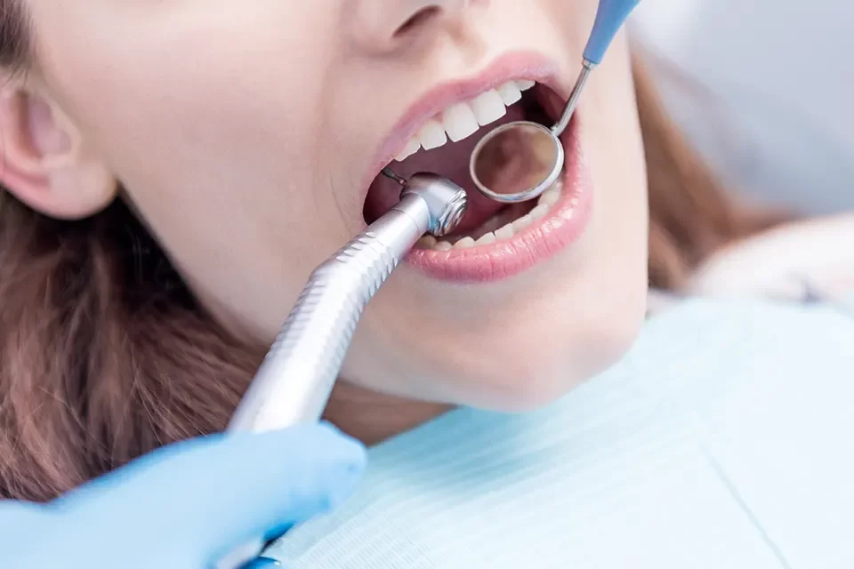 Root Canal Treatment