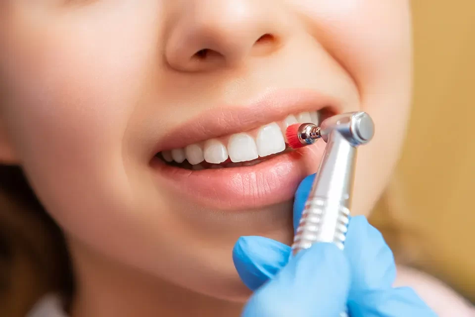 Dental Cleaning