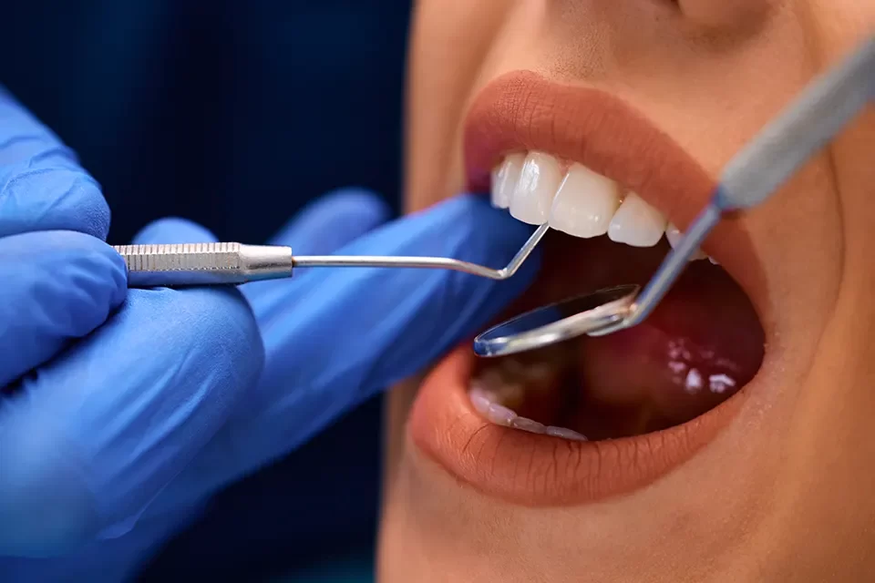 Dental Bonding