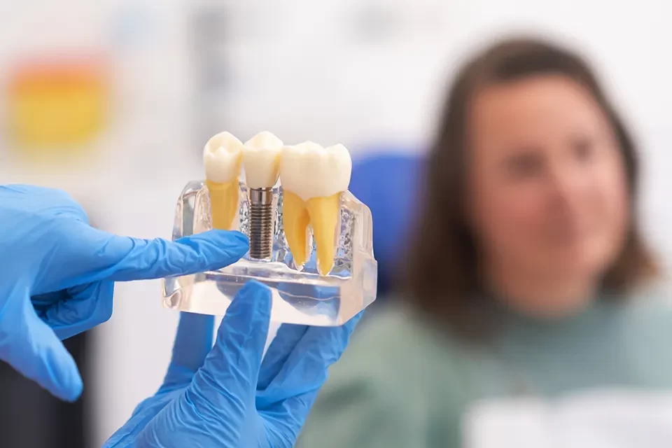 Single Tooth Implants