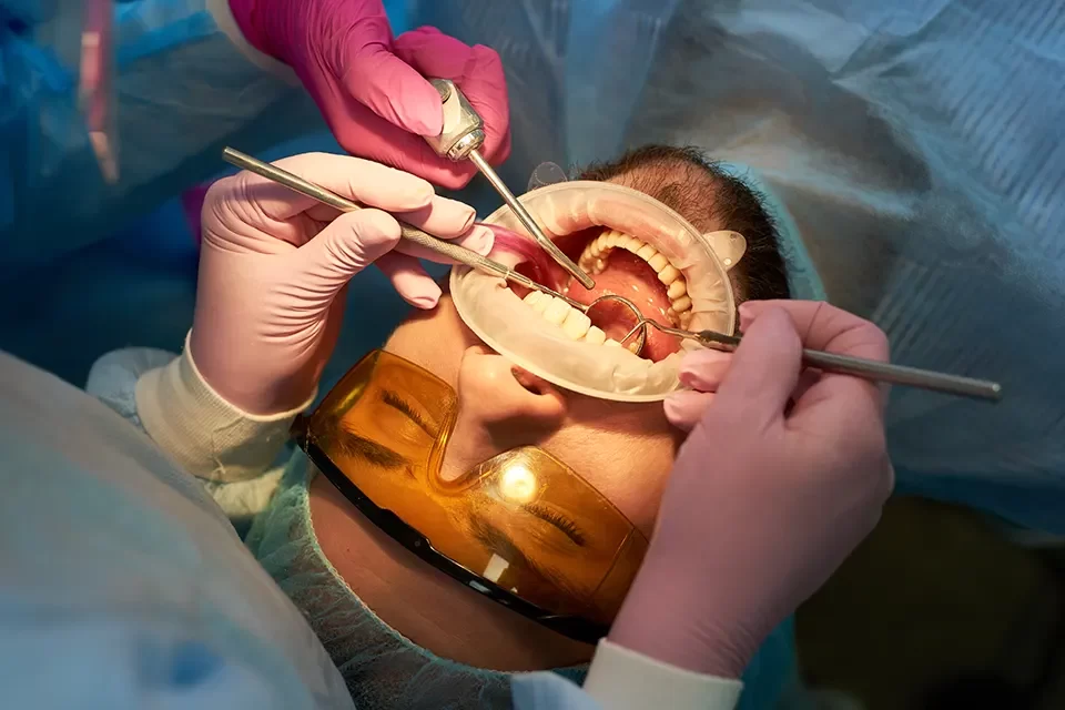 Oral Surgery
