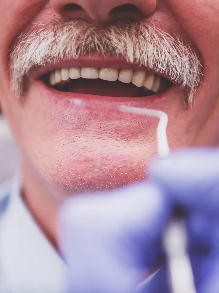 TMJ Treatment
