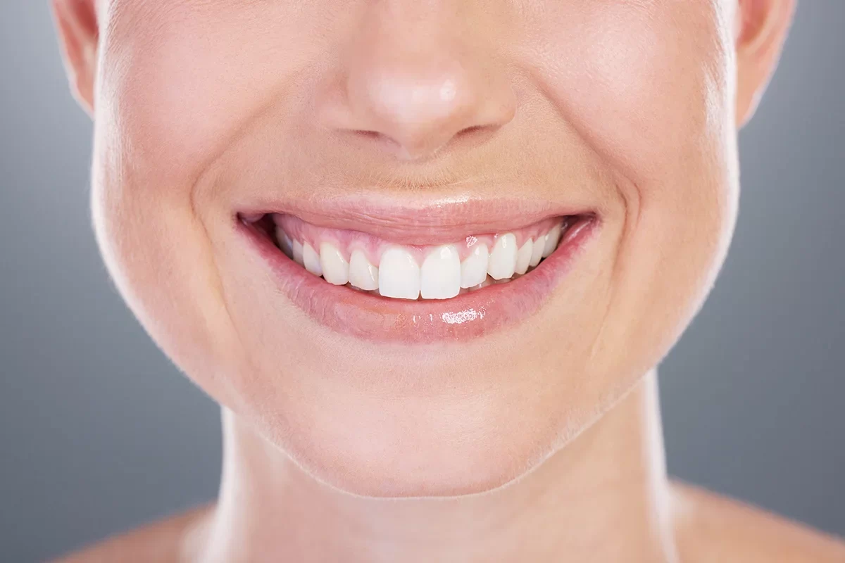 Teeth Whitening