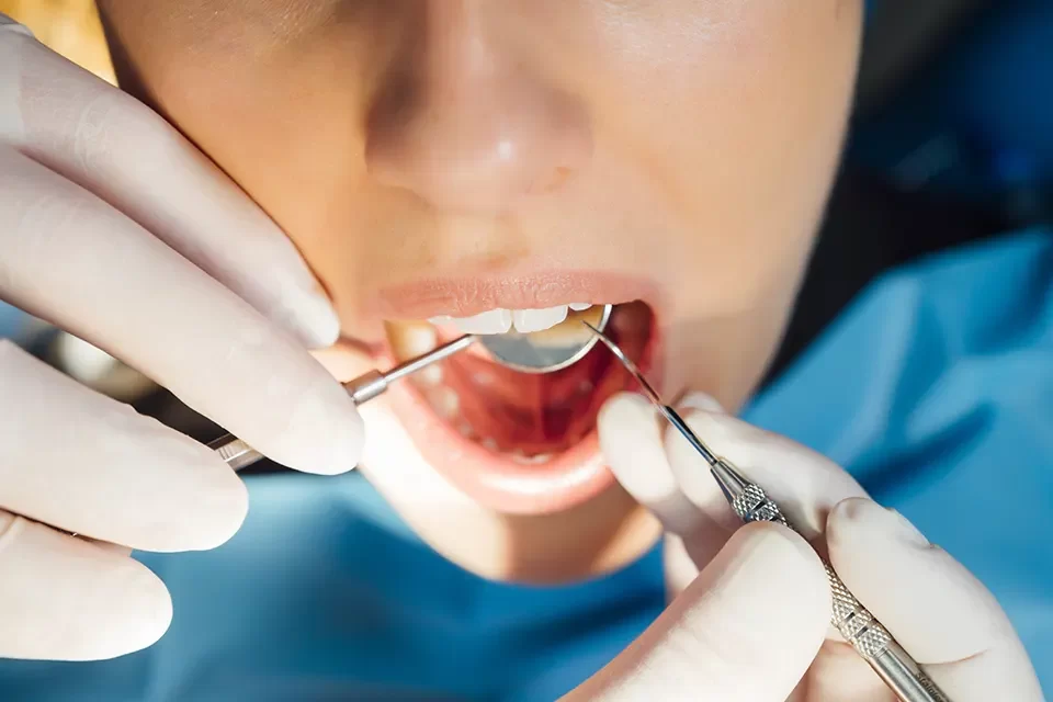 Tongue-Tie Treatment