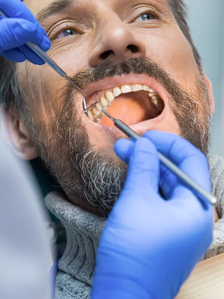 Tongue-Tie Treatment