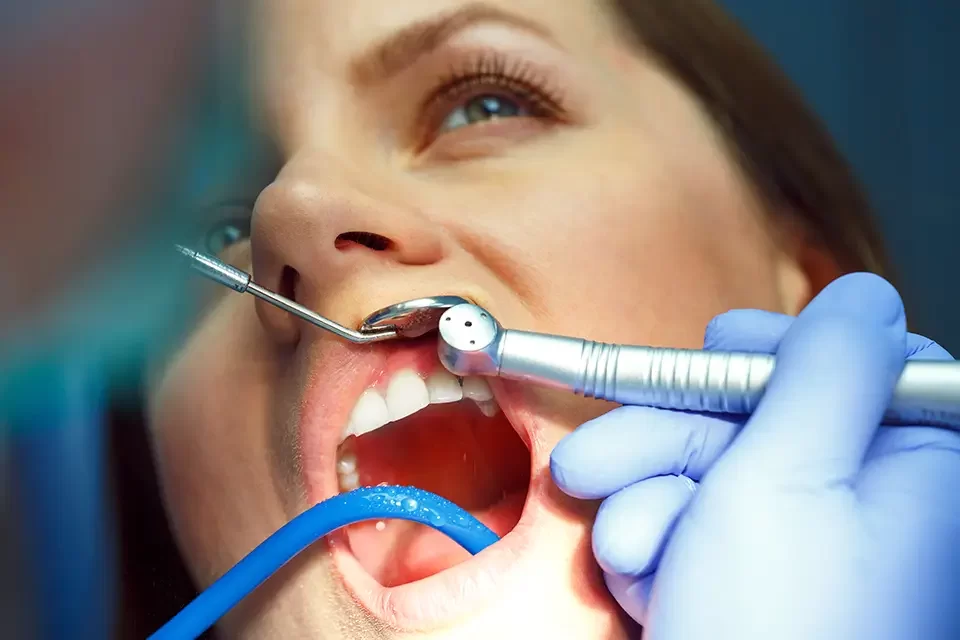 Which Dental Cleaning Service is Best For You?